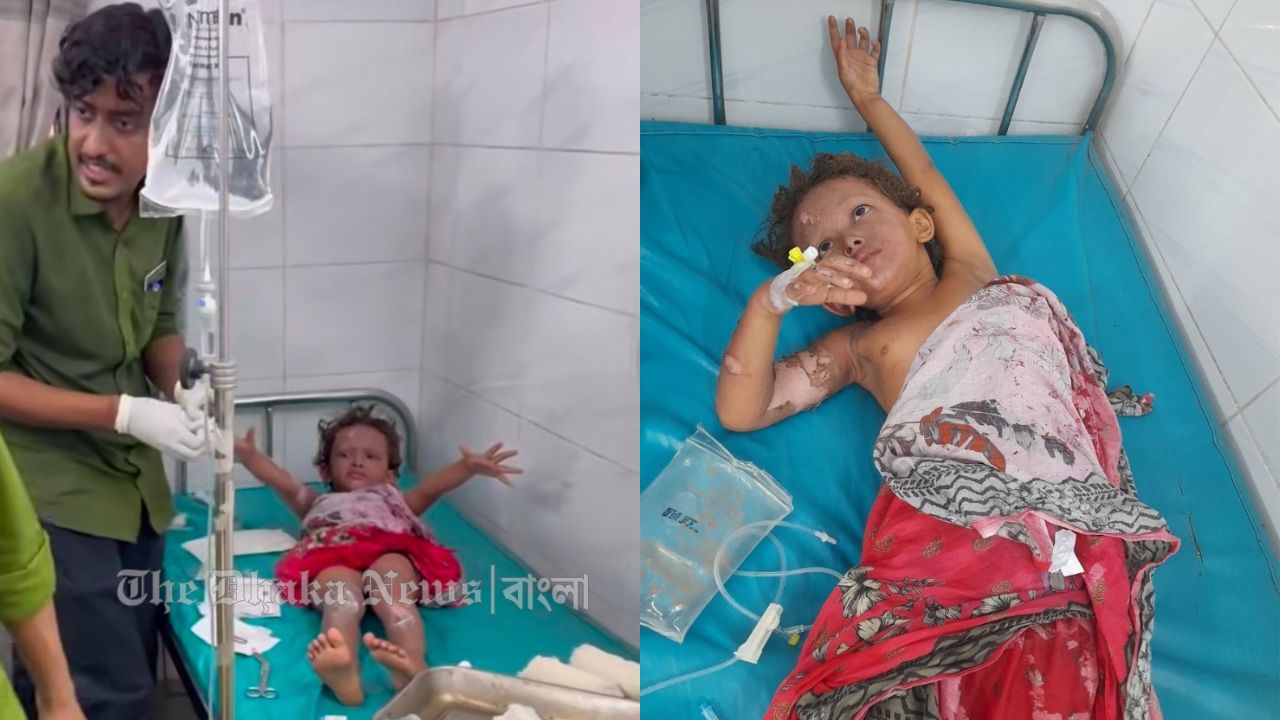 চাঁদপুরে বিদ্যুৎস্পৃষ্ট দগ্ধ শিশু ৫দিন পরে মৃত্যু, অপর শিশু আশঙ্কাজনক